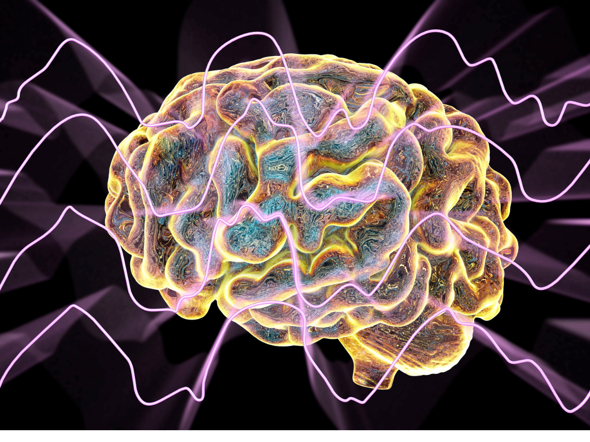 Brain with pink lines going through to explain that the stress response starts in the brain