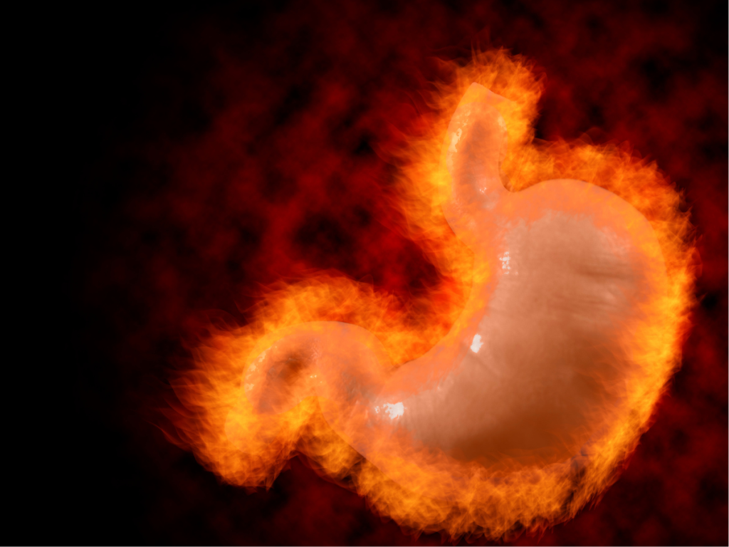 Illustration of stomach on fire to show  acid reflux pain.