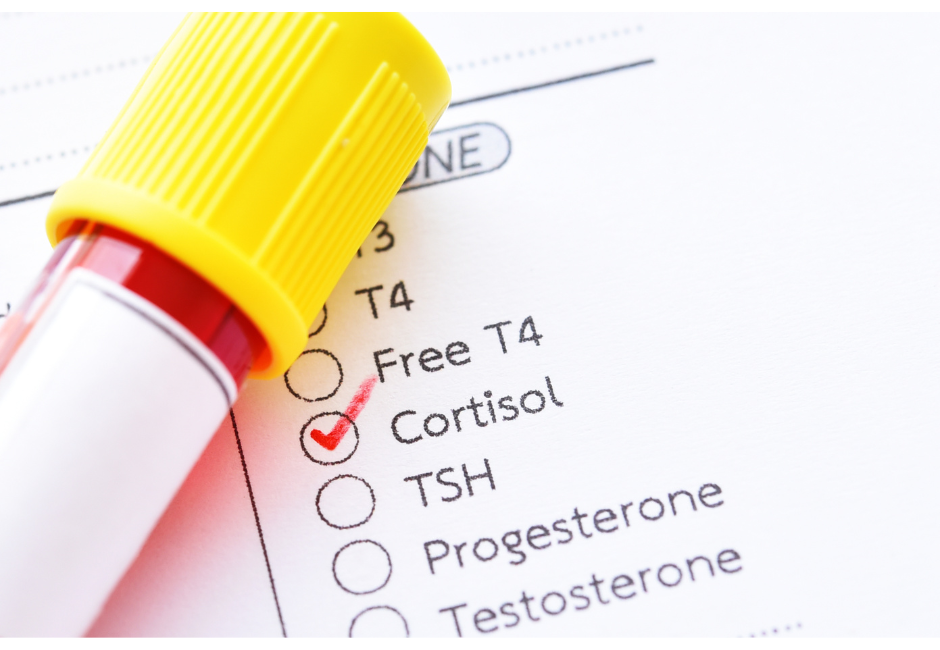 Lab work with cortisol checked 